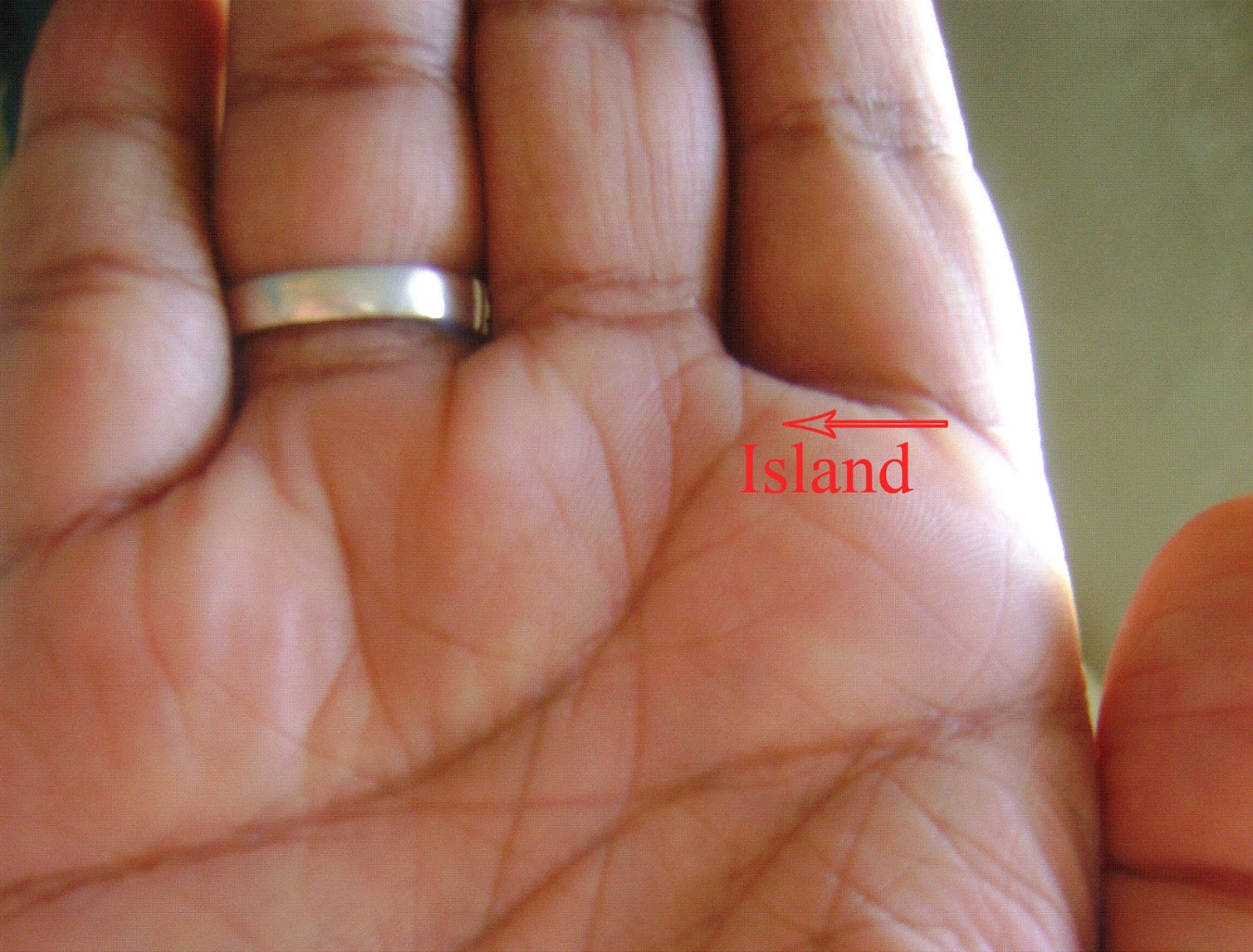 Island On Heart Line Palmistry | INDIAN PALM READING - ASTROLOGY Island On Heart Line Palmistry | INDIAN PALM READING - ASTROLOGY